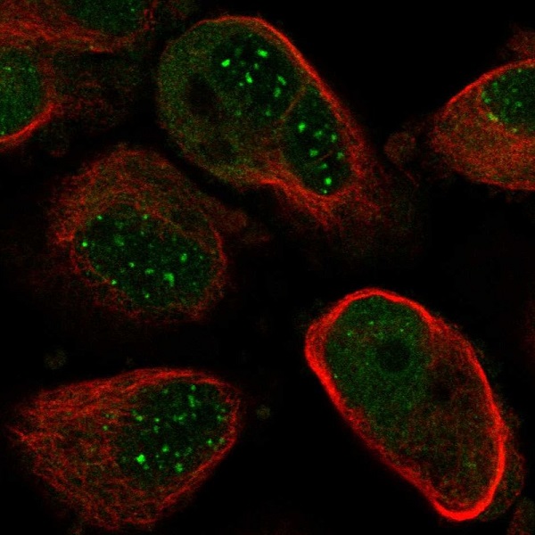Immunocytochemistry/ Immunofluorescence - Anti-NUDT21/CFIM25 antibody (AB221994), expandable thumbnail