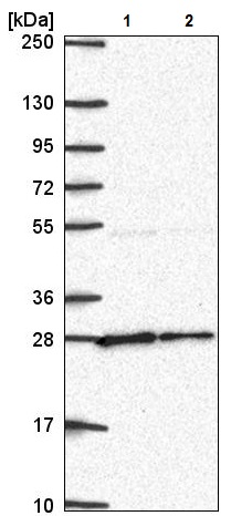 Western blot - Anti-NUDT21/CFIM25 antibody (AB221994), expandable thumbnail