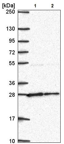 Western blot - Anti-NUDT21/CFIM25 antibody (AB221994)