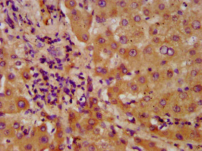 Immunohistochemistry (Formalin/PFA-fixed paraffin-embedded sections) - Anti-NUDT5 antibody (AB238826)