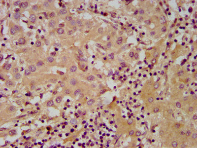 Immunohistochemistry (Formalin/PFA-fixed paraffin-embedded sections) - Anti-NUDT5 antibody (AB238826)