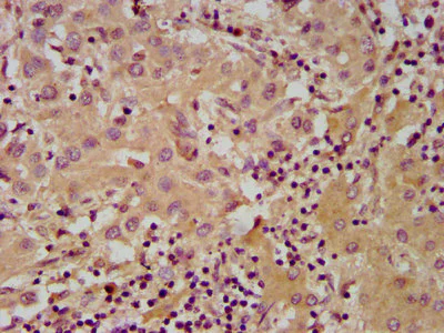 Immunohistochemistry (Formalin/PFA-fixed paraffin-embedded sections) - Anti-NUDT5 antibody (AB238826)