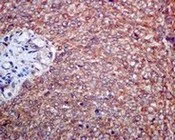 Immunohistochemistry (Formalin/PFA-fixed paraffin-embedded sections) - Anti-NUDT5 antibody [EPR7734] (AB129172)