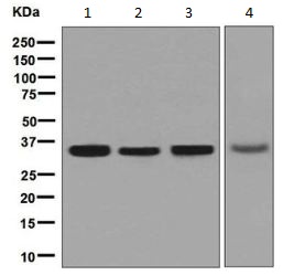 Western blot - Anti-NUDT5 antibody [EPR7735] (AB129163), expandable thumbnail