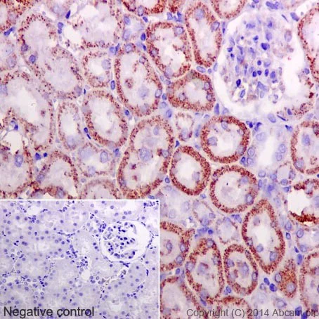 Immunohistochemistry (Formalin/PFA-fixed paraffin-embedded sections) - Anti-NUDT9 antibody [EPR15175] (AB197021)