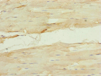 Immunohistochemistry (Formalin/PFA-fixed paraffin-embedded sections) - Anti-Nuf2 antibody (AB230313)