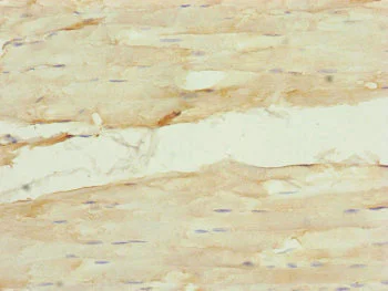 Immunohistochemistry (Formalin/PFA-fixed paraffin-embedded sections) - Anti-Nuf2 antibody (AB230313)