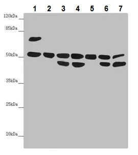 Western blot - Anti-Nuf2 antibody (AB230313)