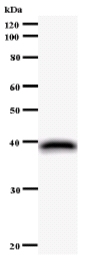 Western blot - Anti-NUFIP1 antibody [2662C1a] (AB59770), expandable thumbnail