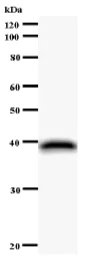Western blot - Anti-NUFIP1 antibody [2662C1a] (AB59770)