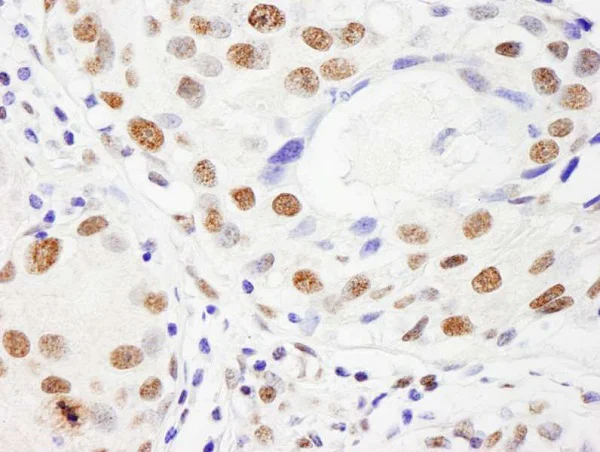 Immunohistochemistry (Formalin/PFA-fixed paraffin-embedded sections) - Anti-NuMA antibody (AB241470)