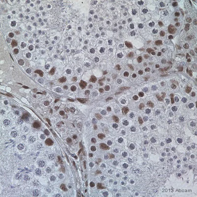 Immunohistochemistry (Formalin/PFA-fixed paraffin-embedded sections) - Anti-NuMA antibody (AB84680)