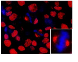 Immunohistochemistry (Formalin/PFA-fixed paraffin-embedded sections) - Anti-NuMA antibody (AB84680)
