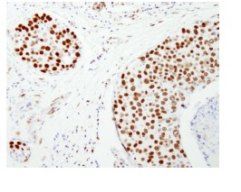 Immunohistochemistry (Formalin/PFA-fixed paraffin-embedded sections) - Anti-NuMA antibody (AB84680)