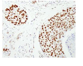 Immunohistochemistry (Formalin/PFA-fixed paraffin-embedded sections) - Anti-NuMA antibody (AB84680)