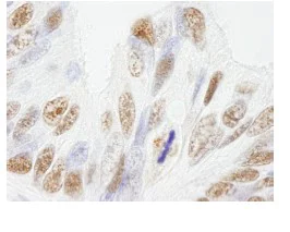 Immunohistochemistry (Formalin/PFA-fixed paraffin-embedded sections) - Anti-NuMA antibody (AB84680)