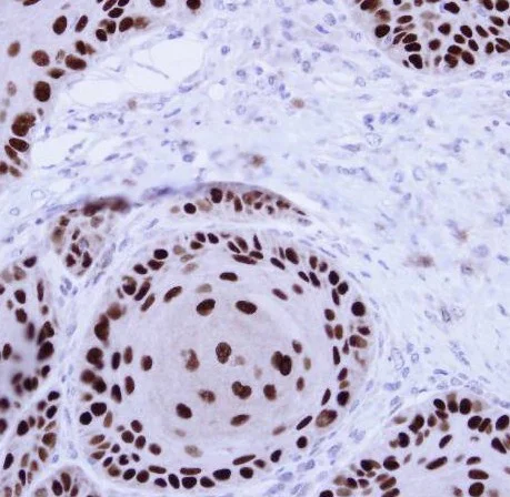 Immunohistochemistry (Formalin/PFA-fixed paraffin-embedded sections) - Anti-NuMA antibody (AB97585)