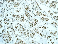 Immunohistochemistry (Formalin/PFA-fixed paraffin-embedded sections) - Anti-NuMA antibody [EP3976] (AB109262)