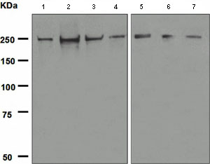 Western blot - Anti-NuMA antibody [EP3976] (AB109262)
