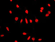 Immunocytochemistry/ Immunofluorescence - Anti-NuMA antibody [EP3976] - BSA and Azide free (AB239963)