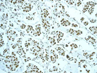 Immunohistochemistry (Formalin/PFA-fixed paraffin-embedded sections) - Anti-NuMA antibody [EP3976] - BSA and Azide free (AB239963)