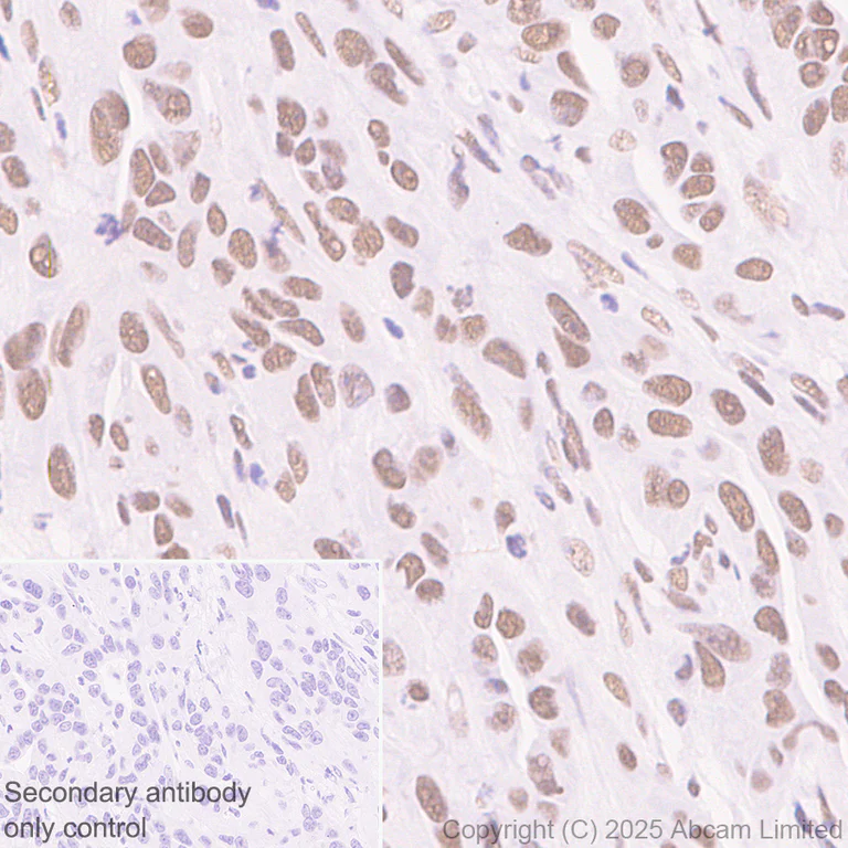 Immunohistochemistry (Formalin/PFA-fixed paraffin-embedded sections) - Anti-NuMA antibody [EP3976] - BSA and Azide free (AB239963)
