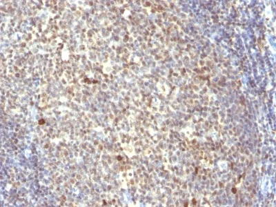 Immunohistochemistry (Formalin/PFA-fixed paraffin-embedded sections) - Anti-NuMA antibody [SPM300] - BSA and Azide free (AB212689)