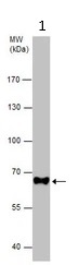 Western blot - Anti-NUMB antibody (AB155415)