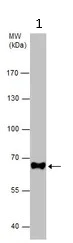 Western blot - Anti-NUMB antibody (AB155415)