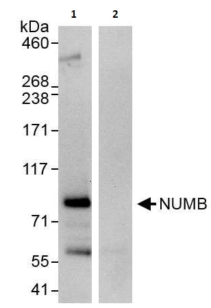 Immunoprecipitation - Anti-NUMB antibody (AB264224)