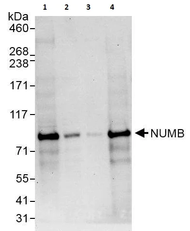 Western blot - Anti-NUMB antibody (AB264224)