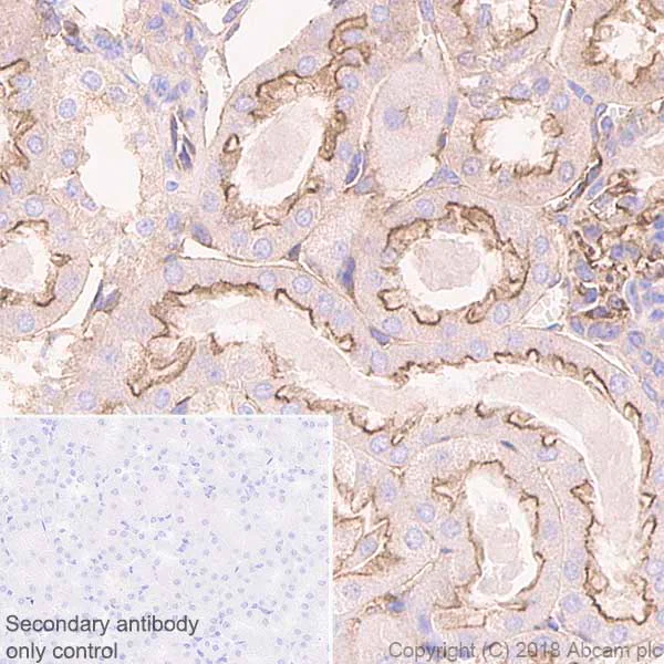 Immunohistochemistry (Formalin/PFA-fixed paraffin-embedded sections) - Anti-NUMB antibody [EPR21988] (AB220362)