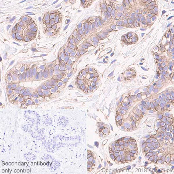 Immunohistochemistry (Formalin/PFA-fixed paraffin-embedded sections) - Anti-NUMB antibody [EPR21988] (AB220362)