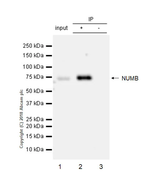 Immunoprecipitation - Anti-NUMB antibody [EPR21988] (AB220362)