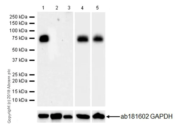 Western blot - Anti-NUMB antibody [EPR21988] (AB220362)