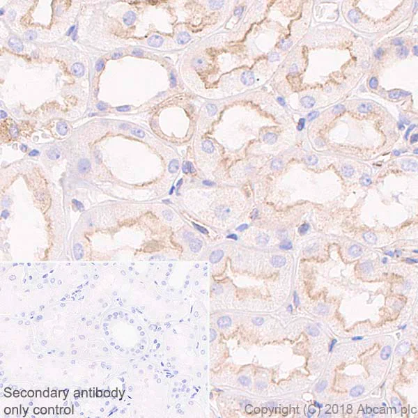 Immunohistochemistry (Formalin/PFA-fixed paraffin-embedded sections) - Anti-NUMB antibody [EPR21988] - BSA and Azide free (AB234108)
