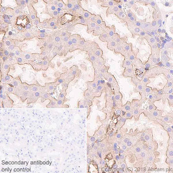 Immunohistochemistry (Formalin/PFA-fixed paraffin-embedded sections) - Anti-NUMB antibody [EPR21988] - BSA and Azide free (AB234108)