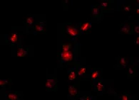 Immunocytochemistry/ Immunofluorescence - Anti-Nup107 antibody (AB73290)