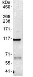 Immunoprecipitation - Anti-Nup107 antibody (AB85916)