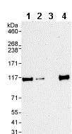 Western blot - Anti-Nup107 antibody (AB85916)
