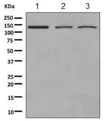 Western blot - Anti-NUP133 antibody [EPR10808(B)] (AB155990)