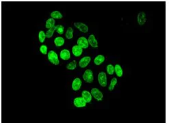 Immunocytochemistry/ Immunofluorescence - Anti-NUP133 antibody [EPR10808(B)] - BSA and Azide free (AB236010)