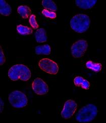 Immunocytochemistry/ Immunofluorescence - Anti-Nup153 antibody (AB84872)