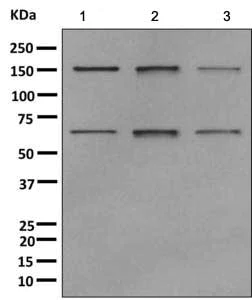 Western blot - Anti-Nup153 antibody [EPR7606(2)(B)] - BSA and Azide free (AB249630)
