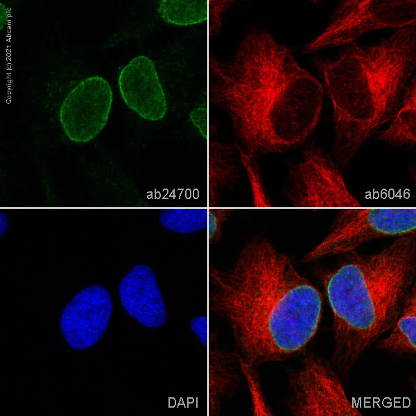 Immunocytochemistry/ Immunofluorescence - Anti-Nup153 antibody [QE5] (AB24700)