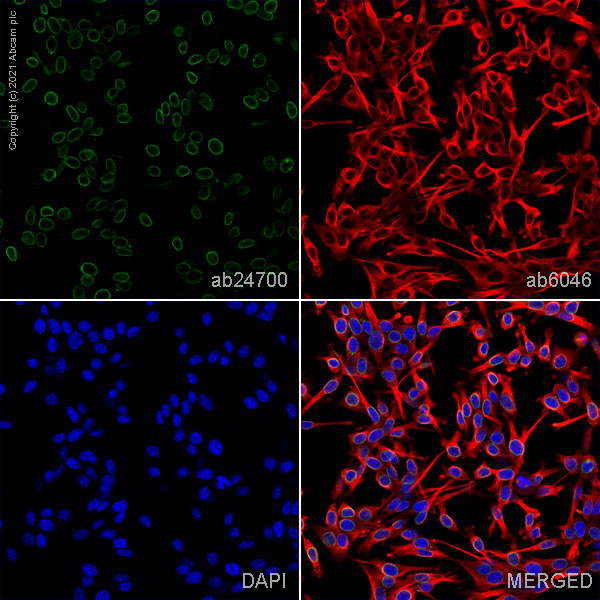 Immunocytochemistry/ Immunofluorescence - Anti-Nup153 antibody [QE5] (AB24700)