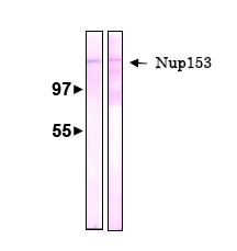 Western blot - Anti-Nup153 antibody [R4C8] (AB81463)