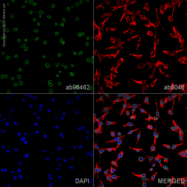 Immunocytochemistry/ Immunofluorescence - Anti-Nup153 antibody [SA1] (AB96462), expandable thumbnail