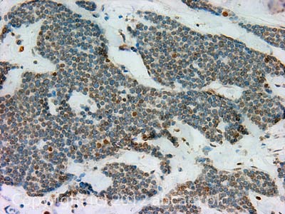 Immunohistochemistry (Formalin/PFA-fixed paraffin-embedded sections) - Anti-Nup153 antibody [SA1] (AB96462), expandable thumbnail