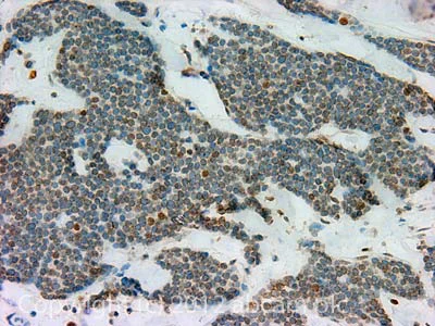 Immunohistochemistry (Formalin/PFA-fixed paraffin-embedded sections) - Anti-Nup153 antibody [SA1] (AB96462)